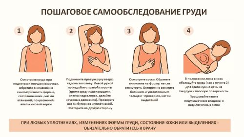Самообследование груди: миф или реальная защита?